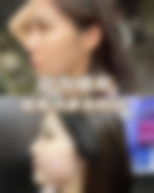 天津滨海新区娅芪媛医疗美容门诊部医生团队经验稳定。