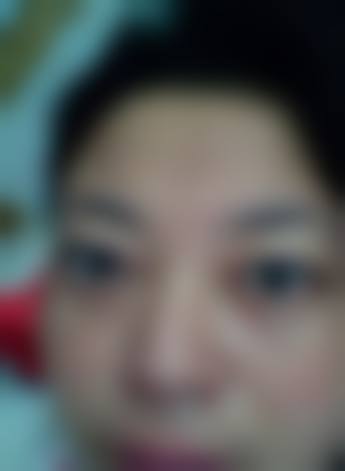 浠水县人民医院眼科预约挂号方式。