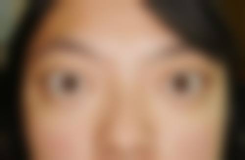 浠水县人民医院眼科擅长项目。