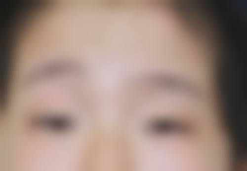 铜陵市立医院眼科擅长项目。