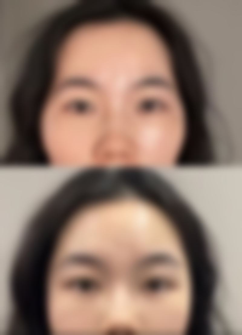 郭增医生擅长项目