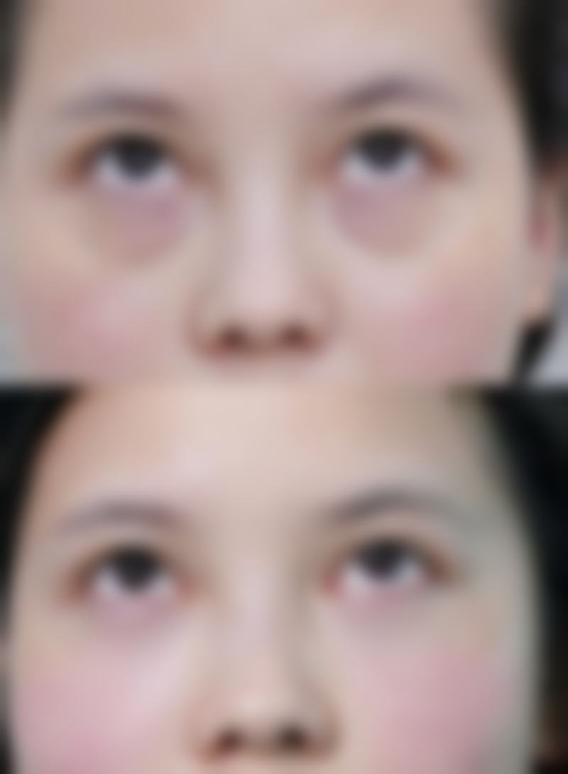 成都润美玉之光医疗美容项目价格