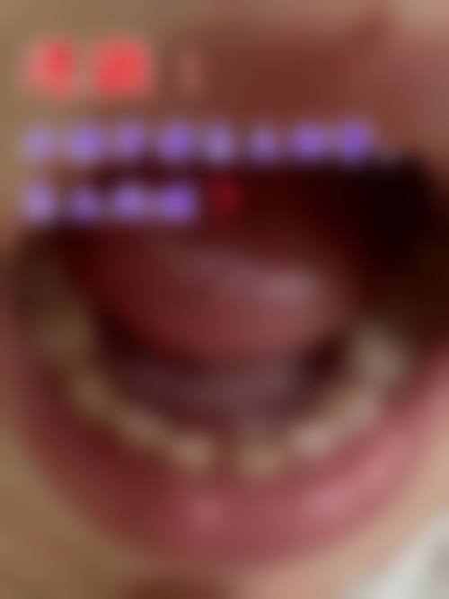 重庆开州严永均口腔治疗反馈与口碑评价。