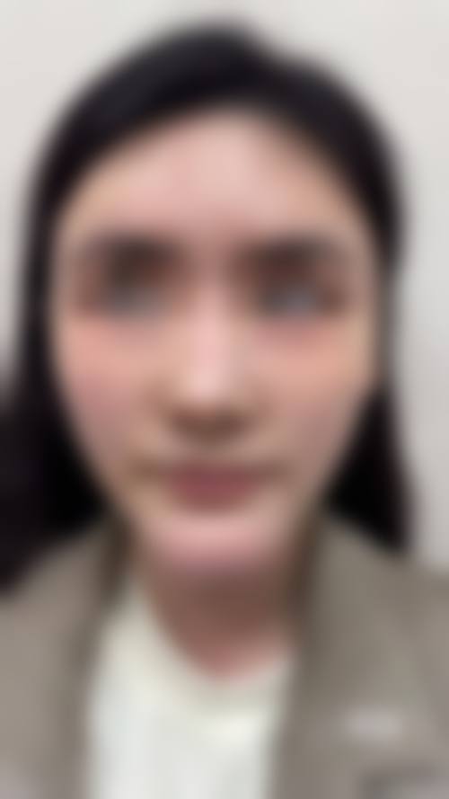 济南第一人民医院美容整形科治疗反馈与口碑评价。