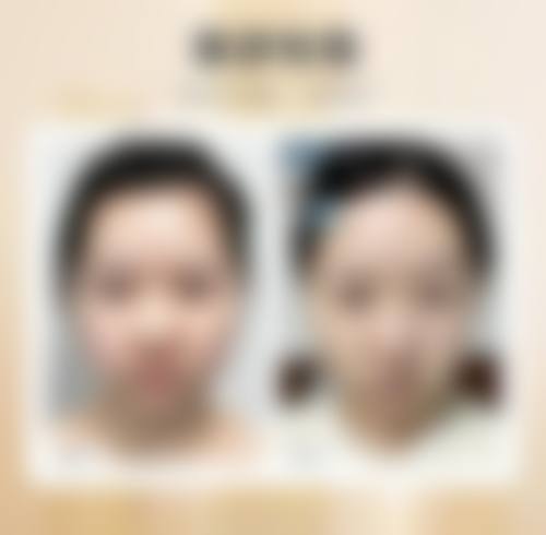 厦门荟美天成外科门诊部治疗反馈与口碑评价。