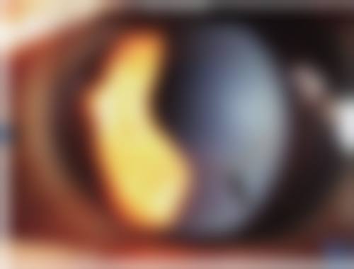 十堰市中医医院眼科擅长项目。