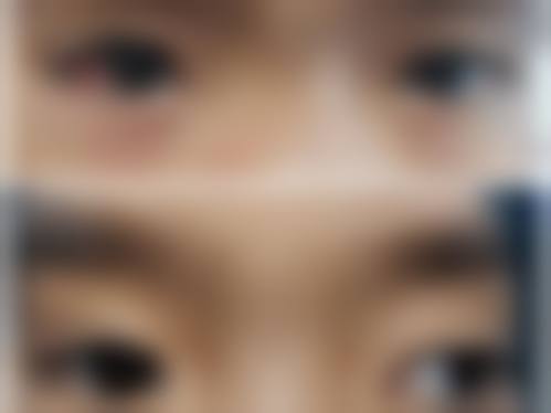 阜阳市肿 瘤医院眼科预约挂号方式。