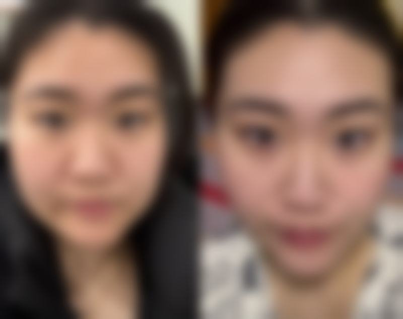谢肇菊医生的技术实力