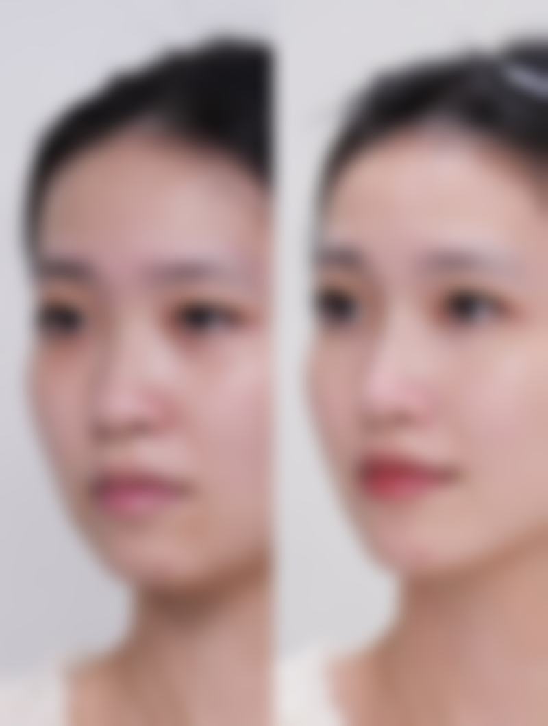 龙卓宏医生的技术实力