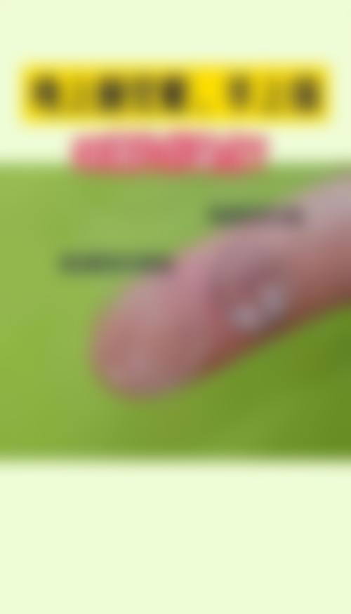 黑龙江省哈尔滨云海眼科医院擅长项目。