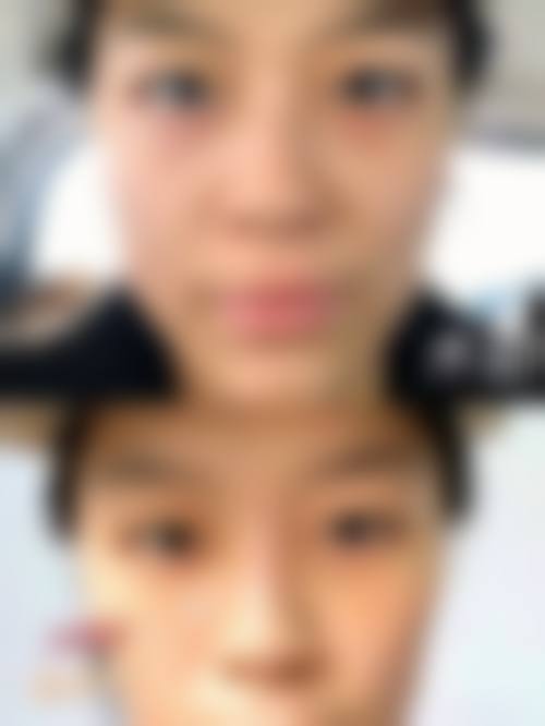 福州安心新颜医疗美容诊所擅长项目。