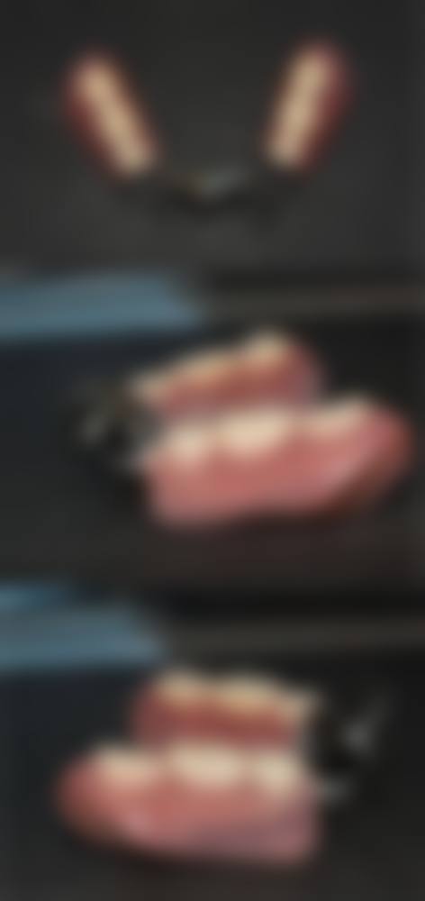 广西都安麻伟达口腔诊所治疗反馈与口碑评价。