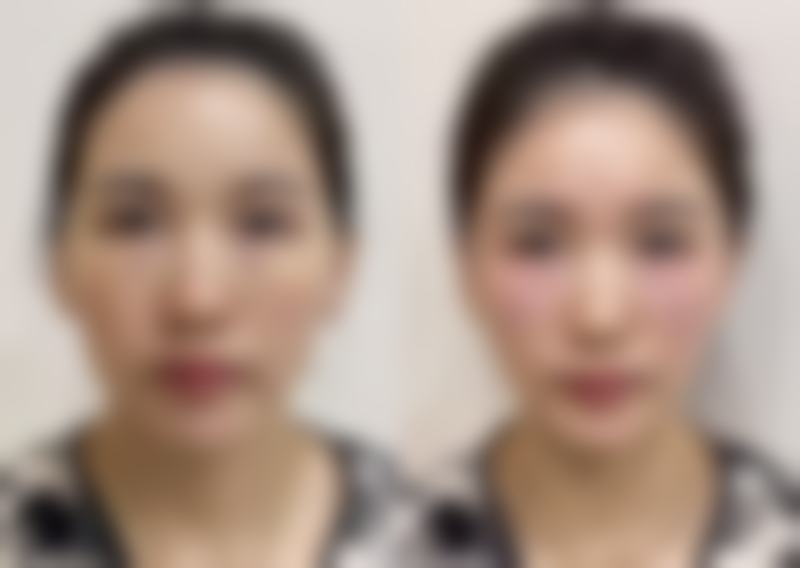蔡怡庭医生擅长项目介绍