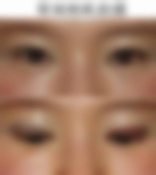 西安科美妍植发医院擅长项目。
