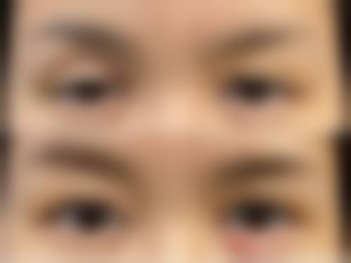 淮北市人民医院眼科医生团队经验稳定。