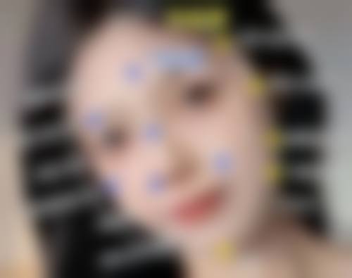 碧莲盛·不剃发植发国内连锁(兰州分院)医生团队经验稳定