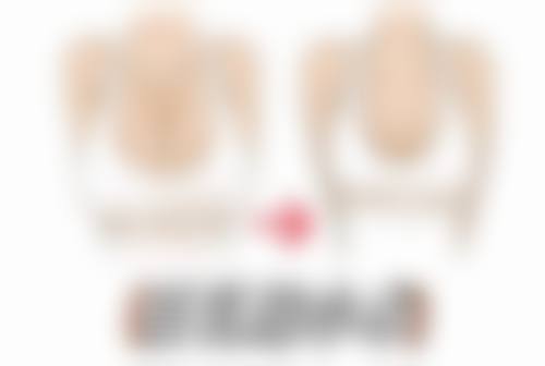 碧莲盛·不剃发植发国内连锁(兰州分院)治疗反馈与口碑评价