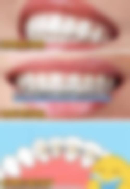 虎门拜尔口腔门诊部擅长项目