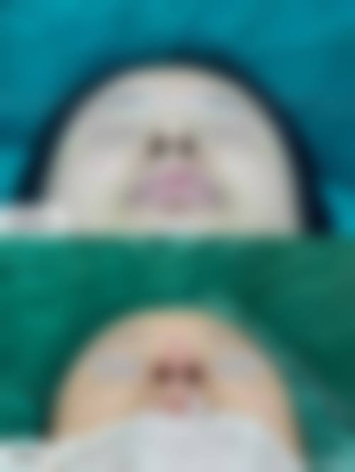 江门福康整形美容医院预约挂号方式。