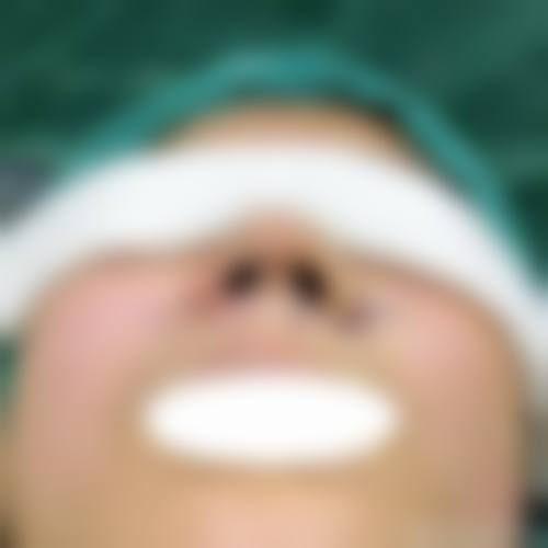 江门福康整形美容医院擅长项目。