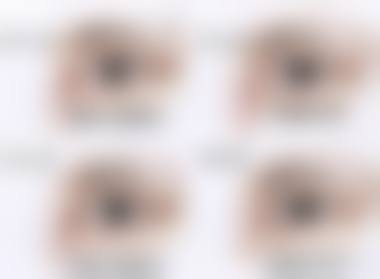 辛集复明医院眼科擅长项目。
