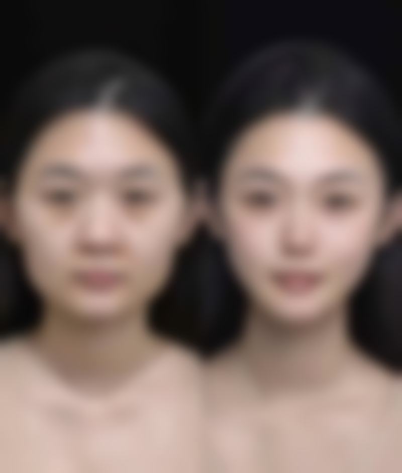 碧莲盛·不剃发植发国内连锁(兰州分院)擅长项目