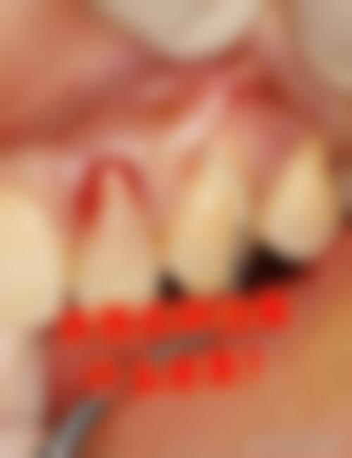 赣州阅牙口腔医生团队经验稳定