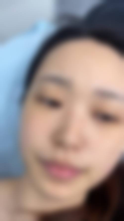 贵州省第二人民医院整形美容科治疗反馈与口碑评价。