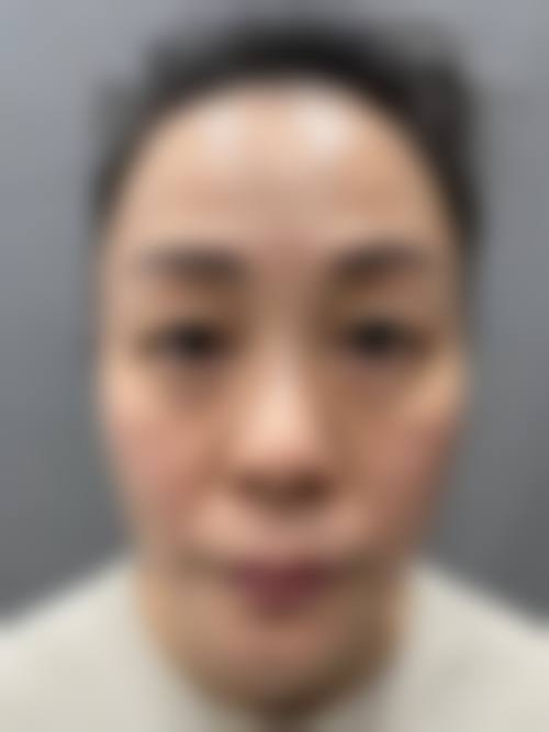 贵州省第二人民医院整形美容科2026年价格收费表: