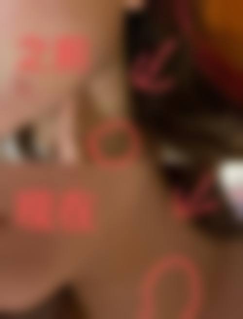 哈尔滨善之美璞龄整形医院擅长项目。