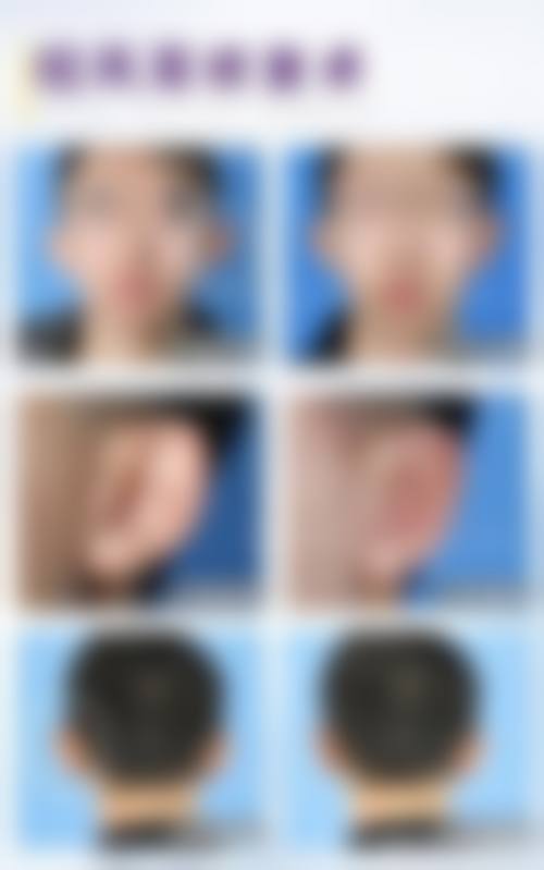 深圳江南春天整形医院预约挂号方式