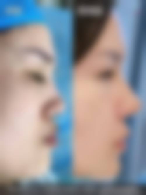 深圳江南春天整形医院门诊营业时间