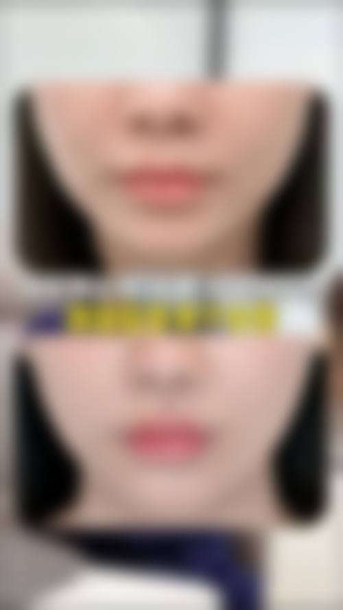 清远丽人整形美容医院治疗反馈与口碑评价。