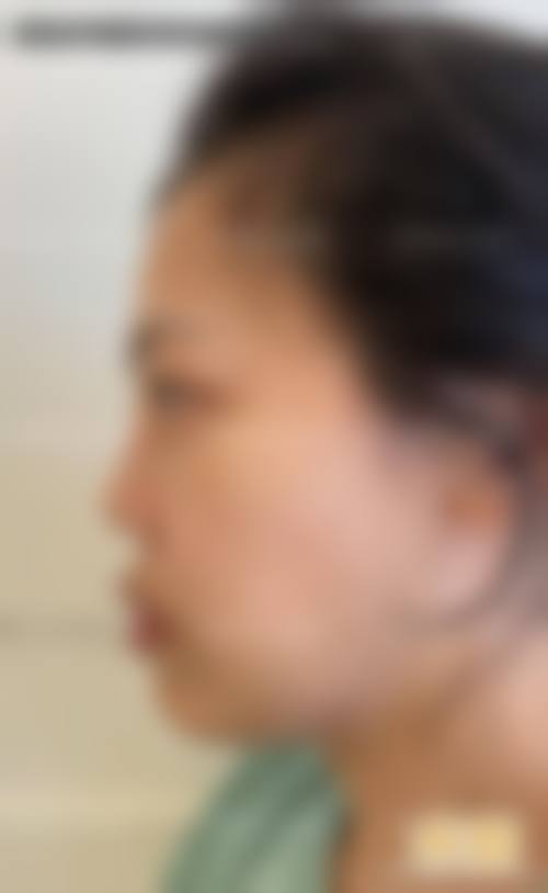 清远丽人整形美容医院医生团队经验稳定。