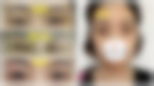 西安安康永秀整形医疗美容门诊部擅长项目。