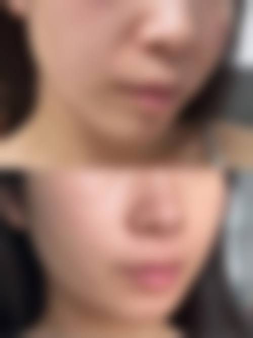 善雅医疗整形美容(馨馨花园社区店)治疗反馈与口碑评价。
