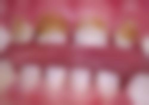 正定雅美口腔诊所治疗反馈与口碑评价。