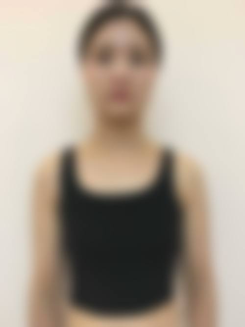 神木梅子熙美整形医院擅长项目