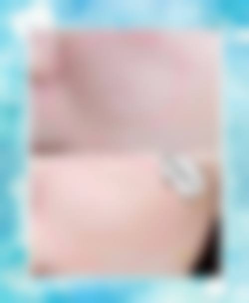 东莞市东城非凡美容医院医生团队经验稳定。