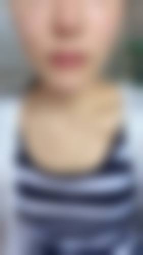 枣庄悦然整形医院预约挂号方式。