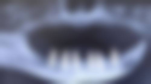擅长项目详解