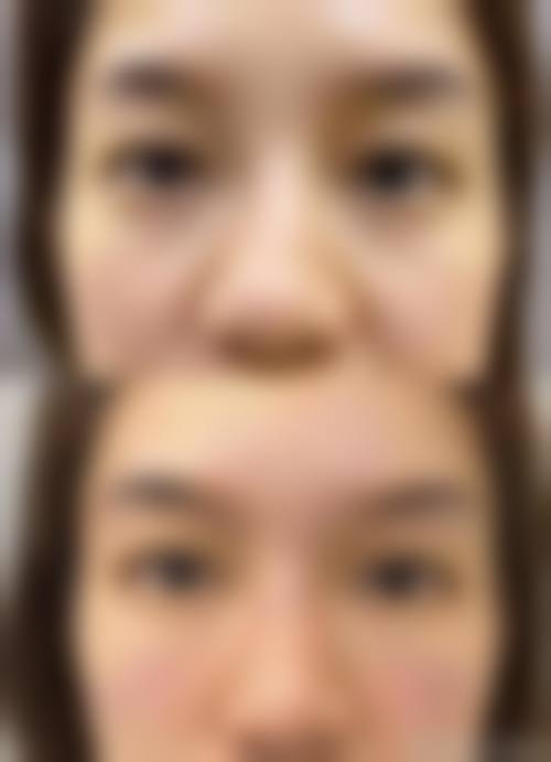 结尾：选择正规医美，开启美丽旅程
