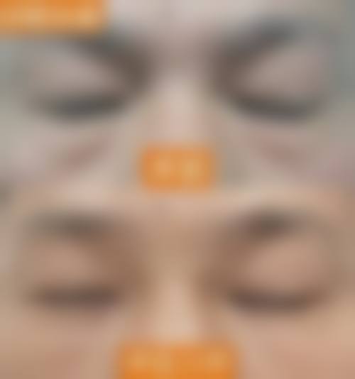 绍兴东方整形诊所医疗美容科擅长项目。