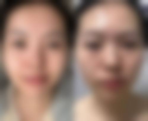 常见疑问解答