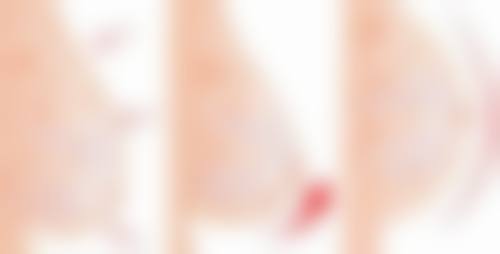 临海璞奢里芙整形医院医生团队经验稳定。