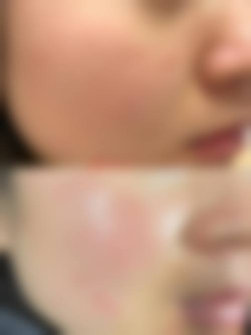 预约优惠活动