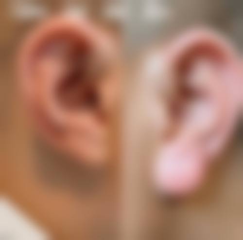 预约优惠活动
