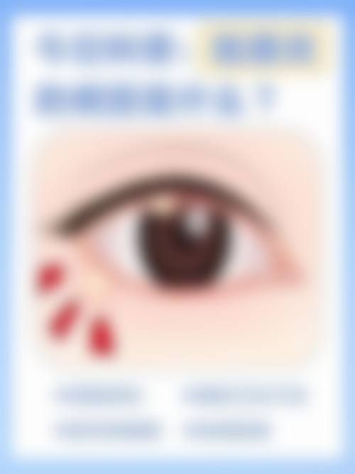 FAQ:常见问题解答