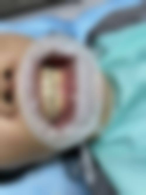 浙江金华永康朗堡口腔门诊部2026年价格收费表：