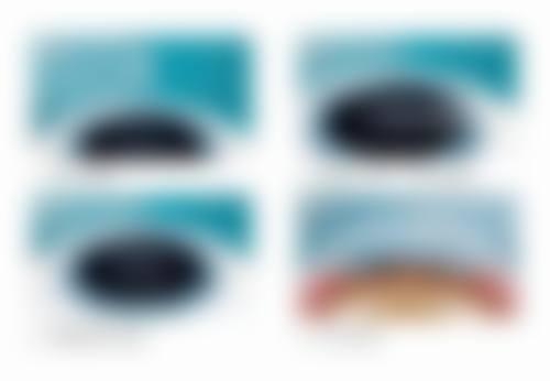 专精设备环境介绍:精细检测保护疗效